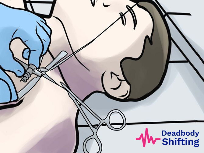 Embalming Services